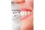 Torque Orthodontics logo