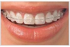 Studfield Dental Group - Wisdom Teeth, Emergencies & Free Orthodontic Consult image 5