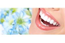 Oracle Dental - Teeth Veneers, Crowns, Straightening &  Whitening image 3