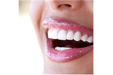 Somersmiles Dental image 4