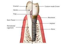Multicare Dental image 8