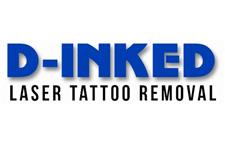 D-inked Tattoo Removal image 1