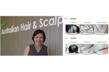 Australian Hair & Scalp Clinic (Aushair) image 3