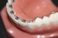 Clear Smile Orthodontics image 8