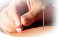 Anitra Thomas ND Whole Health Naturopathics - Acupuncture - Sports Massage image 2