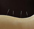 Dylan Watson Acupuncture @ Head 2 Toe Osteopathy logo