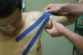 Spring Hill Physiotherapy image 6
