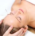 tzone Cosmetic Acupuncture and Facial Rejuvenation logo