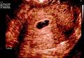 Monash Ultrasound for Women image 2