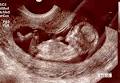 Monash Ultrasound for Women image 1