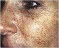 Skin Sensations image 5