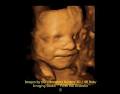 The Ultrasound Nursery 3D 4D Baby Imaging Studio image 2