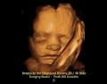 The Ultrasound Nursery 3D 4D Baby Imaging Studio image 3