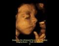 The Ultrasound Nursery 3D 4D Baby Imaging Studio image 6