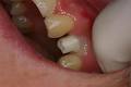 Aesthetic Solutions Dental Ceramics image 2