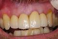 Aesthetic Solutions Dental Ceramics image 4