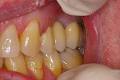 Aesthetic Solutions Dental Ceramics image 5