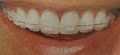 AllStar Orthodontics image 2