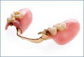 Bakal Denture Clinic image 3