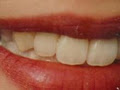 Bakal Denture Clinic image 4