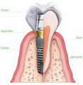 Centre for Cosmetic & Implant Dentistry image 5