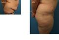 Cosmetic Surgery Clinic - Penrith, Sydney NSW image 3