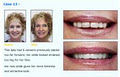 Cosmetic and Laser Dentistry Centre image 2