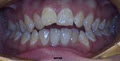 Dr Ashwani Gupta, Orthodontist image 5