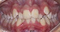 Dr Ashwani Gupta, Orthodontist image 1