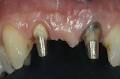 Epping Dental Care image 5