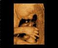 Gladstone Xray & Ultrasound image 3