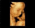 Gladstone Xray & Ultrasound image 4