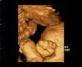 Gladstone Xray & Ultrasound image 5