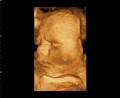 Gladstone Xray & Ultrasound image 6