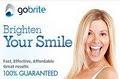 Go Brite Teeth Whitening image 2