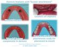 Gold Coast Dental Implants image 2