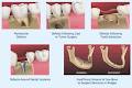 Gold Coast Dental Implants image 3