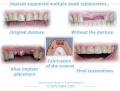 Gold Coast Dental Implants image 4