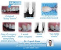 Gold Coast Dental Implants image 6