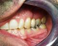 Jacaranda Dental Surgery image 5