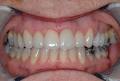 Jacaranda Dental Surgery image 6