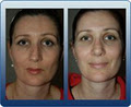 Perth Facial Plastic and Cosmetic Surgery image 4