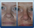 Perth Facial Plastic and Cosmetic Surgery image 1