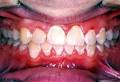 Platinum Orthodontics: Dr Emily Ong image 2