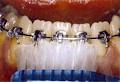 Platinum Orthodontics: Dr Emily Ong image 1