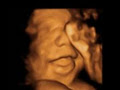 Redcliffe Ultrasound image 2