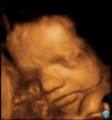 Redcliffe Ultrasound image 3