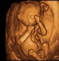 Redcliffe Ultrasound image 1
