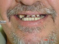 Robert Collins Dental Prosthetist image 2