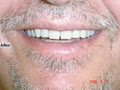 Robert Collins Dental Prosthetist image 3